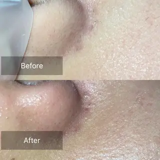 産毛専門店 Bittoのエステ・リラクイメージ