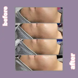 【痩身・脱毛サロン】 REBISKIN🌱のエステ・リラクイメージ