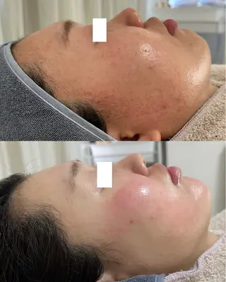 Liber Kyoto所属・魔法の シミ取り職人のエステ・リラクイメージ