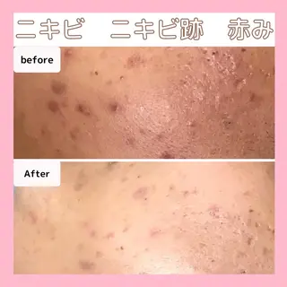 エステサロン　Sブランペタル所属・三沢市エステサロン Sブランペタルのエステ・リラクイメージ