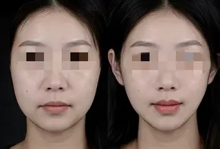 aliaハイフ&水光ジェットサロン所属・aliaハーブ水光店 エステティシャン募集のエステ・リラクイメージ