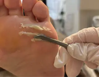 ネイル 自爪育成/深爪矯正salon fam_【ネイルケア・エステ脱毛】所属・自爪育成/深爪矯正 salon fam_のネイルデザイン