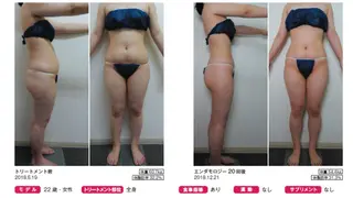 オレンジバナナ 亀貝インター店のエステ・リラクイメージ