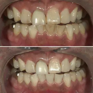 メンズ キッズ 217whitening  room所属・217 ホワイトニングルームのエステ・リラクイメージ