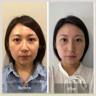 Belle et douce所属・毛穴ケア専門サロン ベルエドゥースのエステ・リラクイメージ