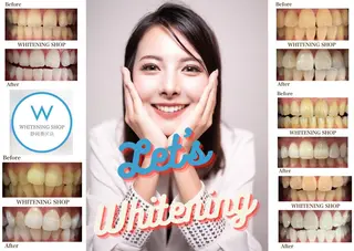 ホワイトニングショップ静岡葵区店所属・ホワイトニング ショップ葵区静岡駅店のその他イメージ