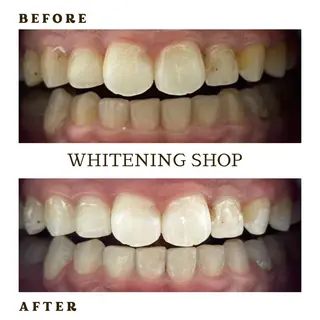 メンズ ホワイトニング ショップ葛西店のその他イメージ