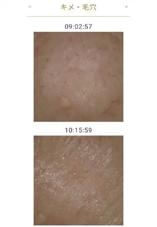 メナードフェイシャルサロンライズミュー所属・鈴木 由美のエステ・リラクイメージ