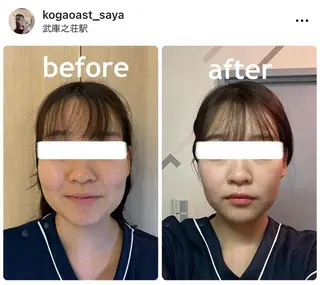 小顔矯正サロンAST【アスト】所属・小顔矯正サロン AST【アスト】のその他イメージ