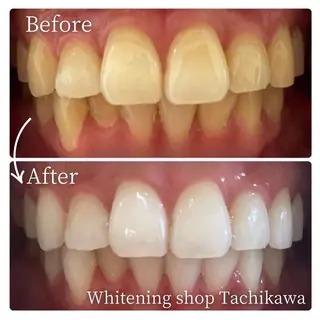 セルフ　ホワイト ニングショップ立川のその他イメージ