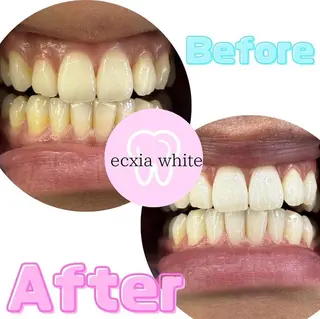 エクシアホワイトニング草津店所属・nanami -ホワイトニングのその他イメージ