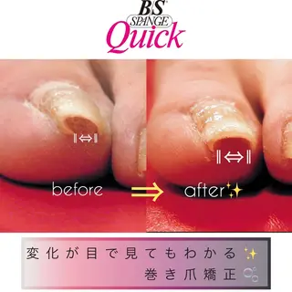 ネイル Tiara♛ティアラ 山口くるみのネイルデザイン