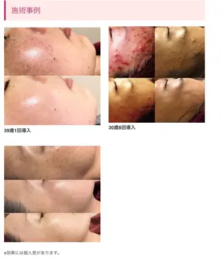 bibiche Rのエステ・リラクイメージ