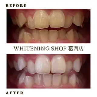 メンズ ホワイトニング ショップ葛西店のその他イメージ