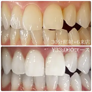 メンズ ホワイトニングルーム　川崎店所属・ホワイトニング ルーム　川崎店のその他イメージ