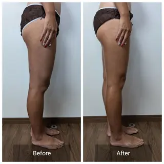 nail RiRi アトレナチュラのエステ・リラクイメージ