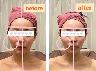 糸島 エステサロンmiuのエステ・リラクイメージ