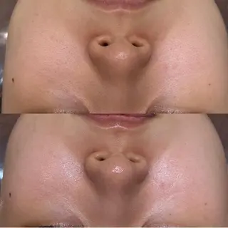 ♡美バスト美姿勢♡ 池袋TUKADA☆のエステ・リラクイメージ