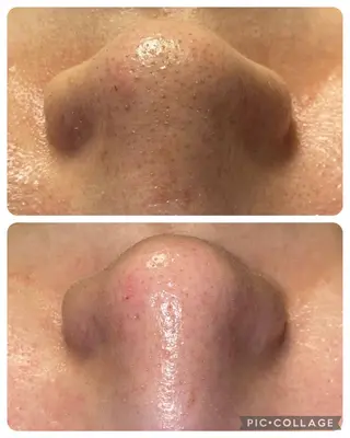 SOLUNA目黒店所属・小顔/毛穴洗浄/痩身 ayako🌿のエステ・リラクイメージ