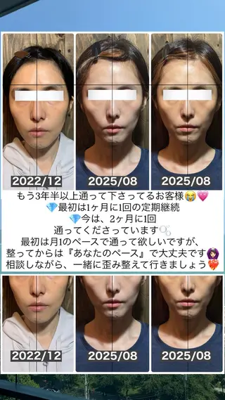 💎後悔させない小顔 矯正💎イトヤマ🌱のエステ・リラクイメージ