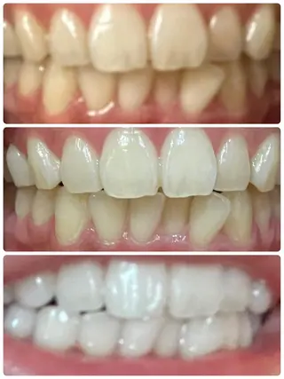 nail salon Na.(エヌエー)所属・nailsalon Na.のネイルデザイン