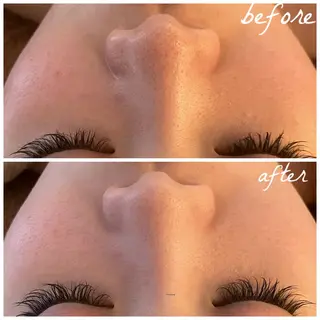 メンズ メナード岐阜市茜部 杉浦のエステ・リラクイメージ