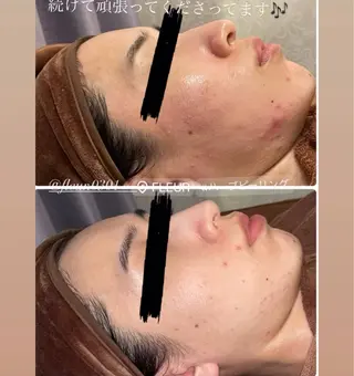 FLEUR 2号店のエステ・リラクイメージ