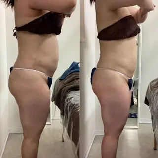 美肌専門サロン RUBONのエステ・リラクイメージ