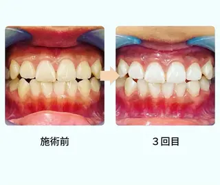 メンズ脱毛サロンReyz（レイズ）所属・熊本メンズ脱毛サロン Reyz（レイズ）のエステ・リラクイメージ