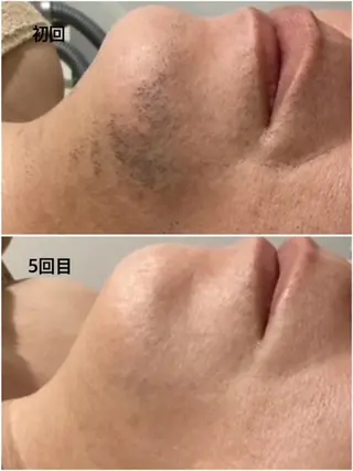 メンズ Pullulant EstheKyotoのエステ・リラクイメージ