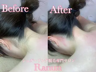 マツエク・マツパ シュガーリング脱毛 専門店Ranunのエステ・リラクイメージ