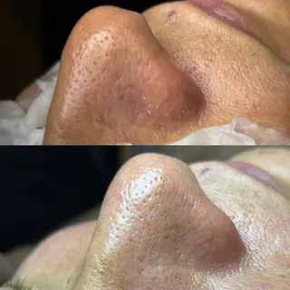 セルフエステエンリケ明石大久保店所属・夕希リンパ&痩身& 脱毛&毛穴ケアのエステ・リラクイメージ