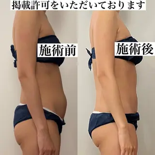 Blanca 錦糸町店のマツエク・マツパデザイン