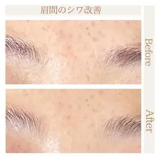 国分寺南口 【RIORA】パラジェルエリートサロン所属・ハーブピーリング・ Mikaのメニューのエステ・リラクイメージ