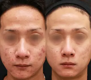 脱毛＆シェービング専門店　心斎橋所属・脱毛＆シェービング 専門店LUANAのエステ・リラクイメージ