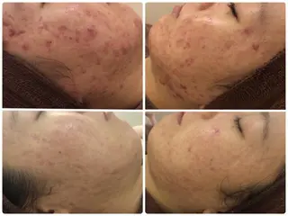 ミディアム カラー パーマ ヘアアレンジ メンズ キッズ ネイル マツエク・マツパ ニキビ・肌質改善専門 ♡人生が変わるサロンのエステ・リラクイメージ