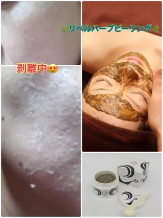 【リベルハーブピーリング認定店】敏感肌・美白脱毛専門店Dione立川店所属・Dione 立川店のエステ・リラクイメージ