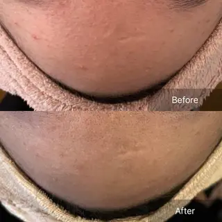 堀井 舞琳のエステ・リラクイメージ