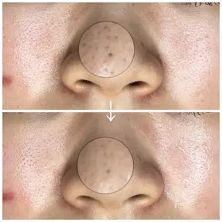 ROUN'　南 鈴沙のネイルデザイン