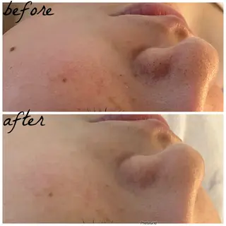 メンズ メナード岐阜市茜部 杉浦のエステ・リラクイメージ