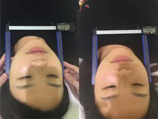 小顔矯正/美容整体 /骨盤矯正✨+Mi2のエステ・リラクイメージ