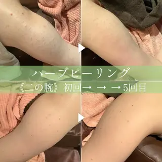 JIGGLY★ ミニモ限定クーポンのエステ・リラクイメージ