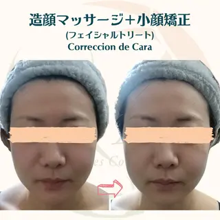 小顔矯正☀︎バスト ☀︎ハルのエステ・リラクイメージ