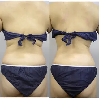 B againのエステ・リラクイメージ