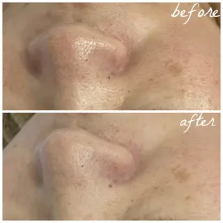 メンズ メナード岐阜市茜部 杉浦のエステ・リラクイメージ