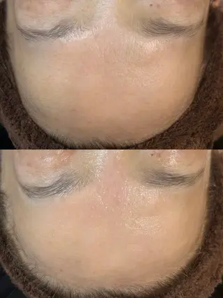 beauty  salon sorelle所属・艶肌/角質ケア フェイシャルワックスのエステ・リラクイメージ