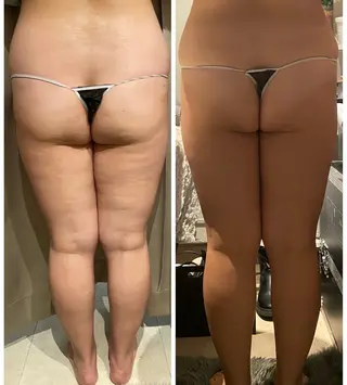 【痩身・脱毛サロン】 REBISKIN🌱のエステ・リラクイメージ