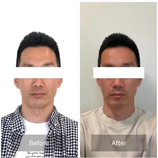 小顔と ヘッドスパのお店のエステ・リラクイメージ