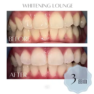 ホワイトニングラウンジ横須賀所属・ホワイトニング Lounge横須賀のその他イメージ