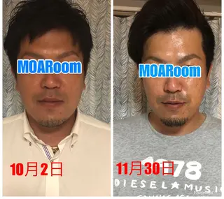 メンズ MOARoom所属・毛利 明代のエステ・リラクイメージ